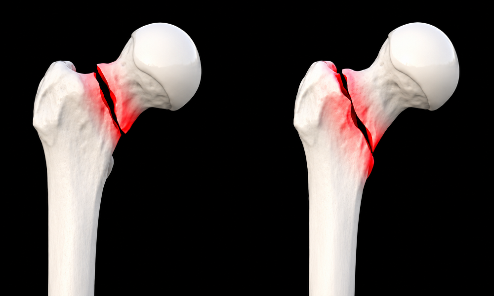 Fracture Care Layout